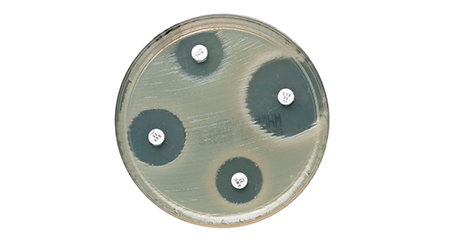 Microbiology Susceptibility Testing